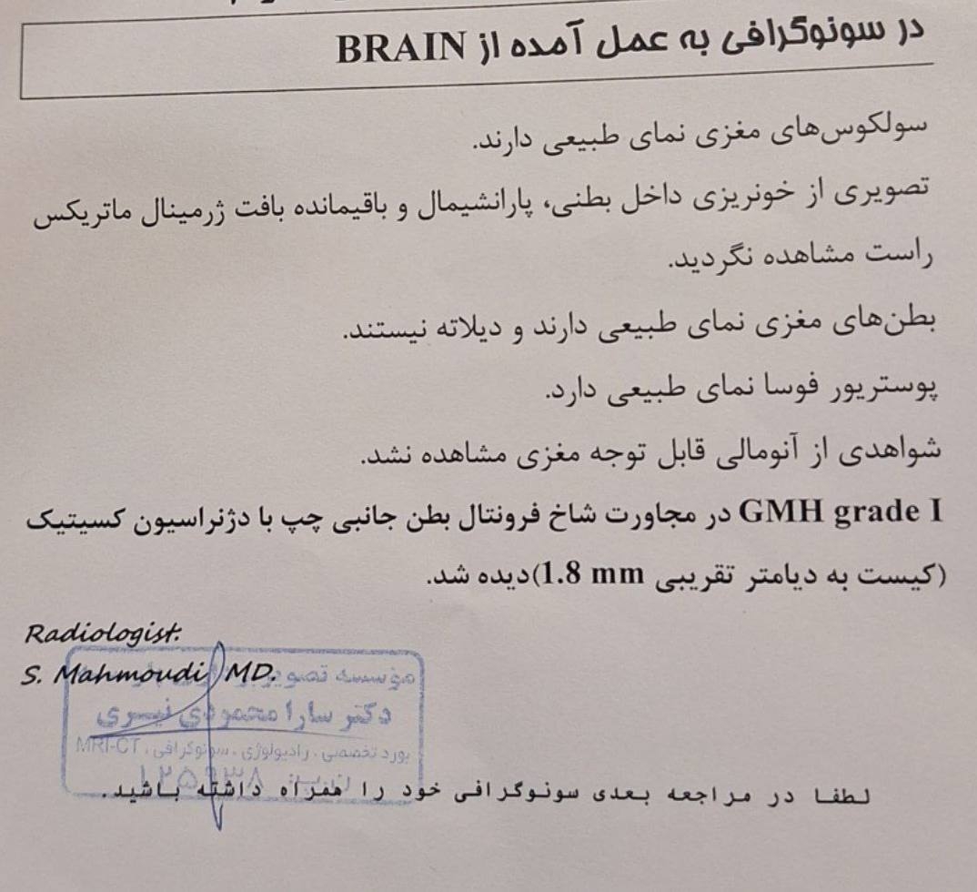 کیست سر نوزاد