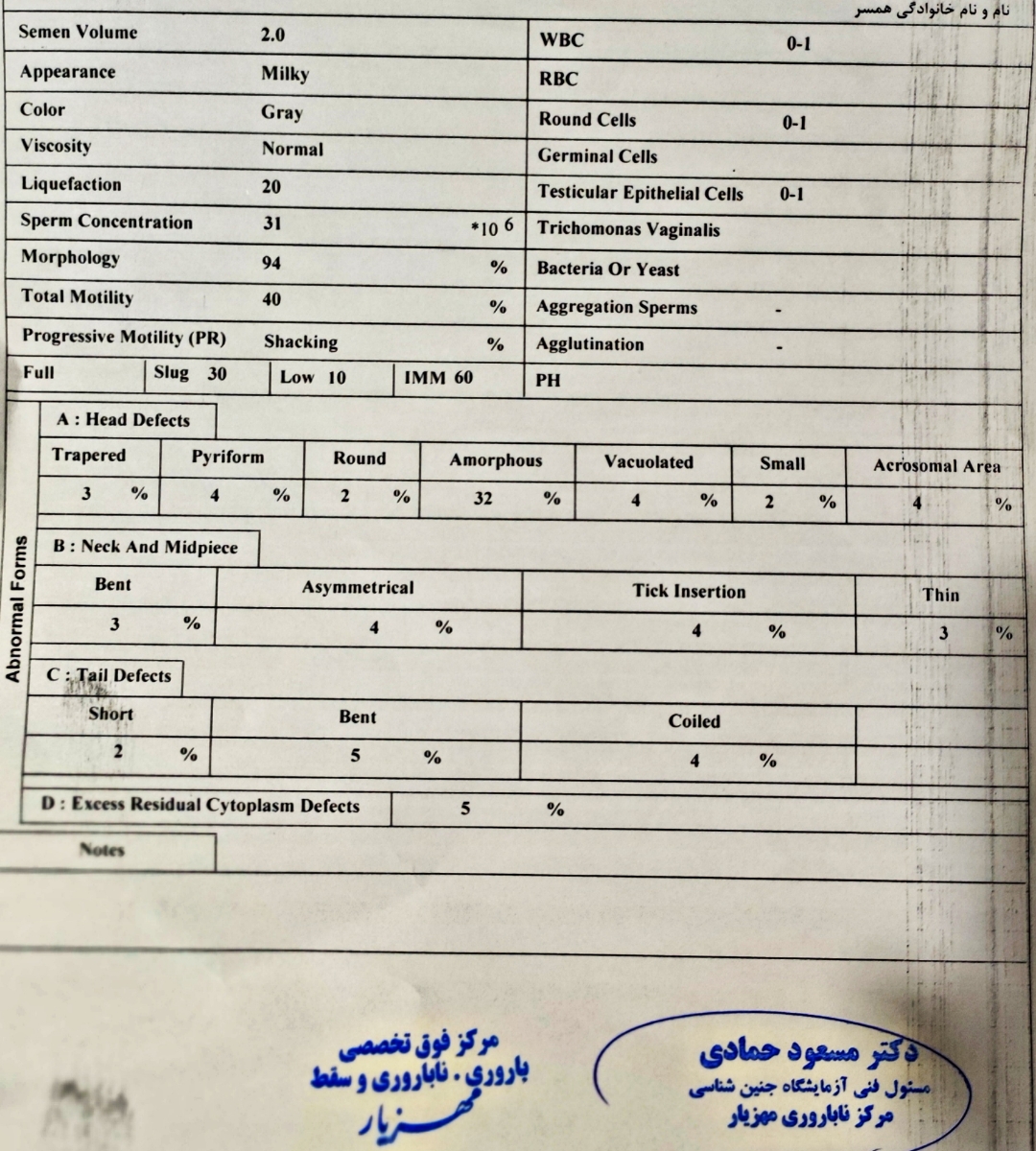 آزمایش اسپرم و dfi