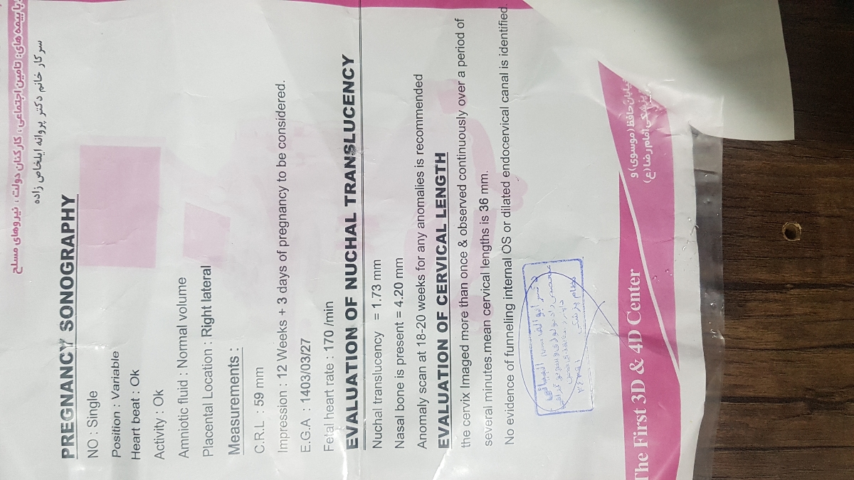 آزمایش ان تی بارداری