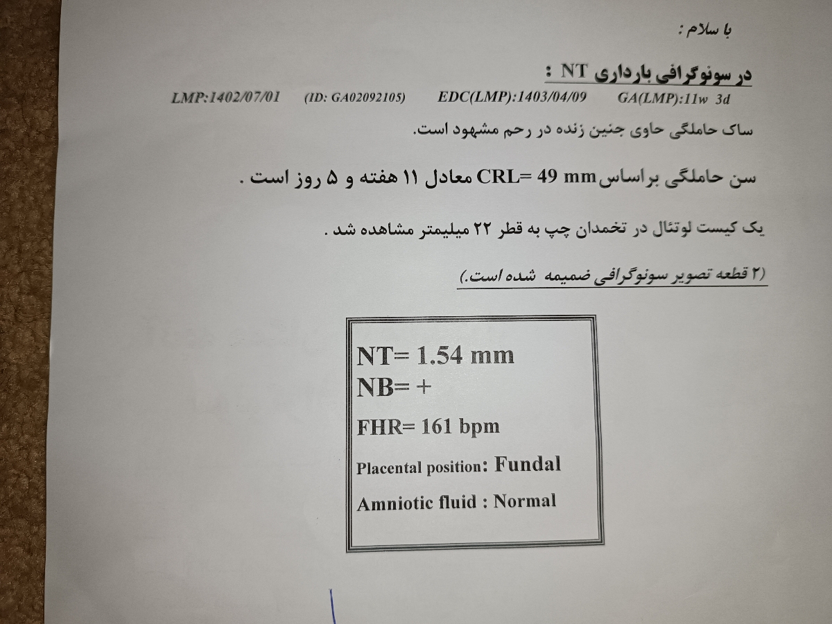 سونو ان تی بارداری