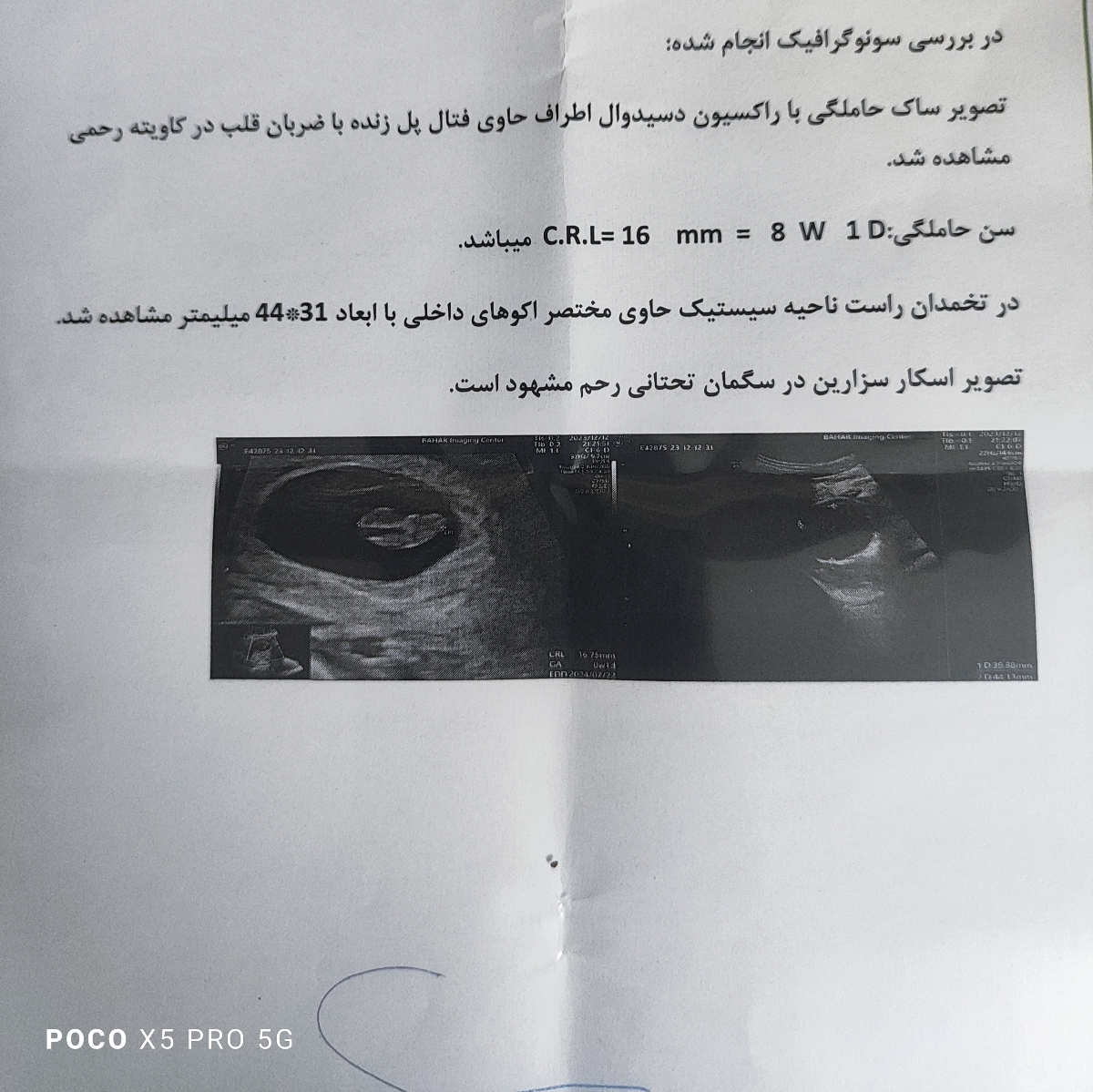 تفسیر سونو تفسیر سونو تفسیر سونو تفسیر سونو