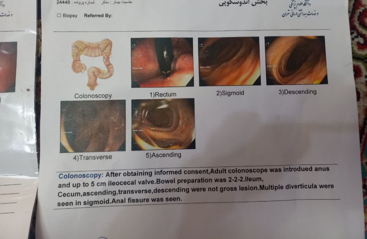 تفسیر جواب کلونوسکوپی ممنون