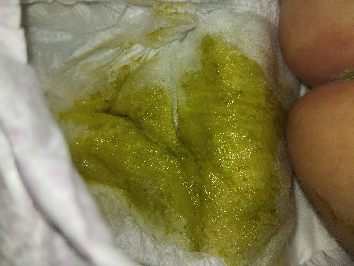 مدفوع سبز و خلطی نوزاد
