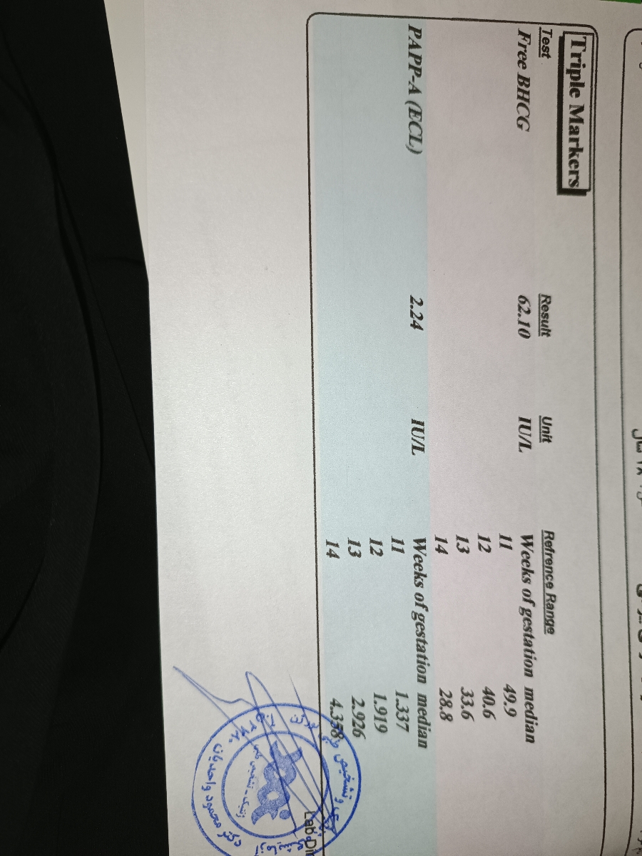 سونو ان تی بارداری