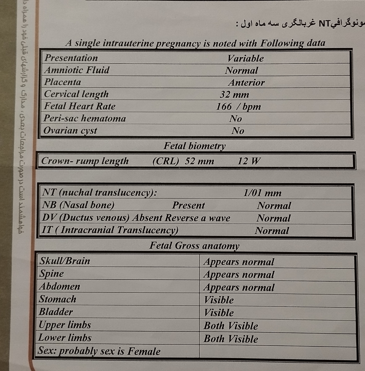 جفت قدامی در بارداری