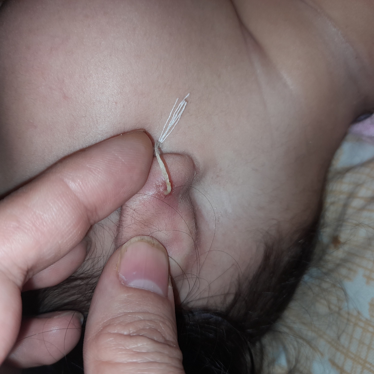 سوراخ کردن گوش بچه ۷ ماهه سوراخ کردن گوش بچه ۷ ماهه