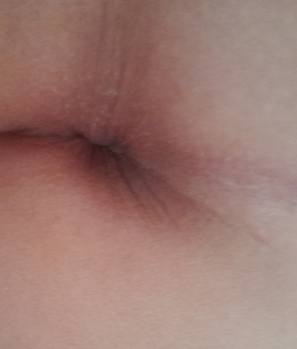 مدفوع کودک ۱۶ ماهه