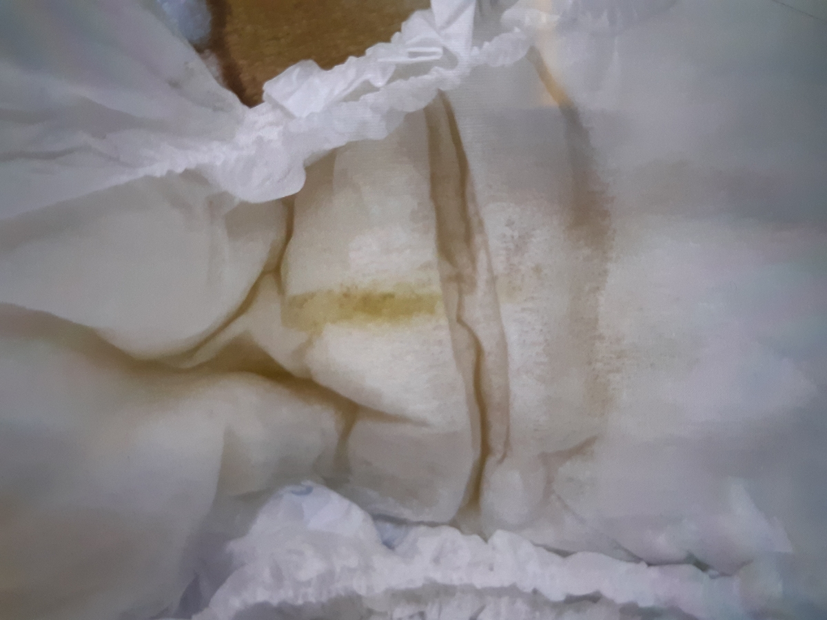سلامدکتر جان و دوستای اومایی نوزاد من از واژنش ترشح رنگی میاد میشه ببینبد سلامدکتر جان و دوستای اومایی نوزاد من از واژنش ترشح رنگی میاد میشه ببینبد