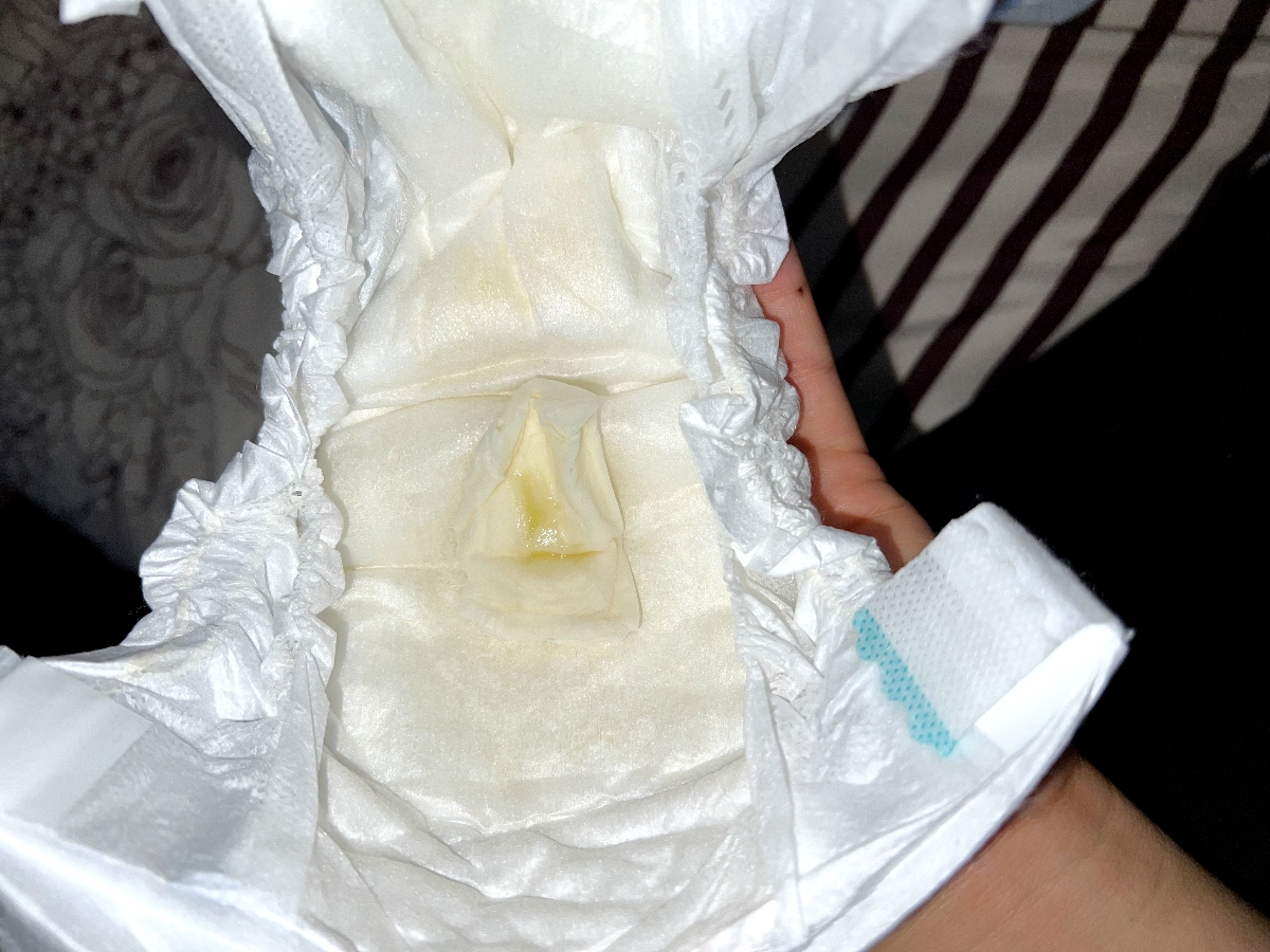 سلامدکتر جان و دوستای اومایی نوزاد من از واژنش ترشح رنگی میاد میشه ببینبد سلامدکتر جان و دوستای اومایی نوزاد من از واژنش ترشح رنگی میاد میشه ببینبد
