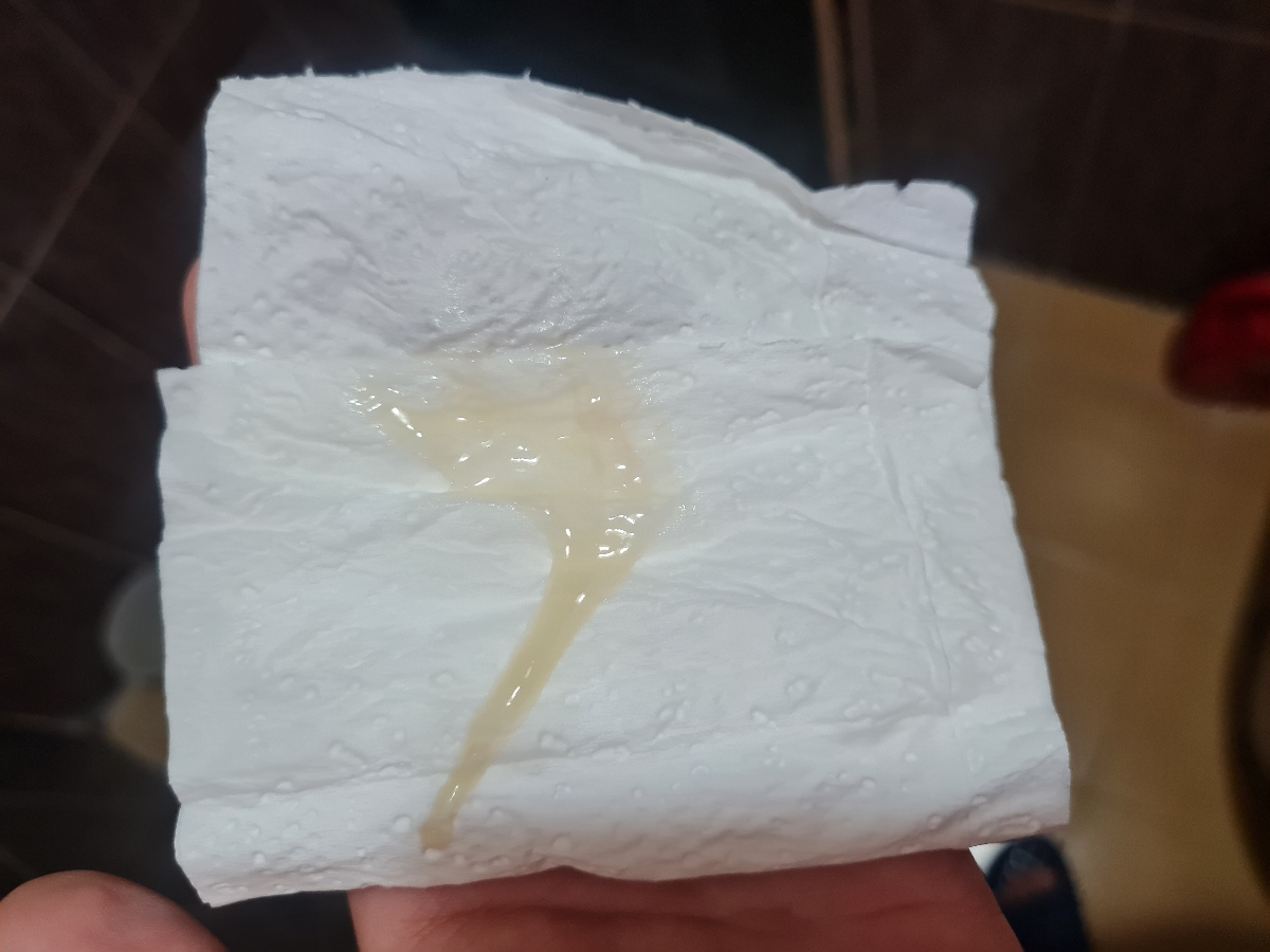 افزایش ترشحات در هفته ۲۶