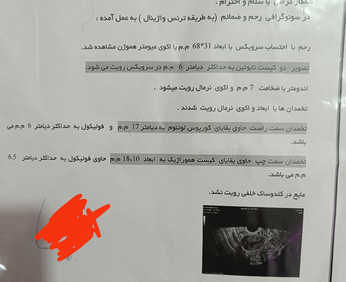 تفسیر سونوی فولیکول 14سیکل