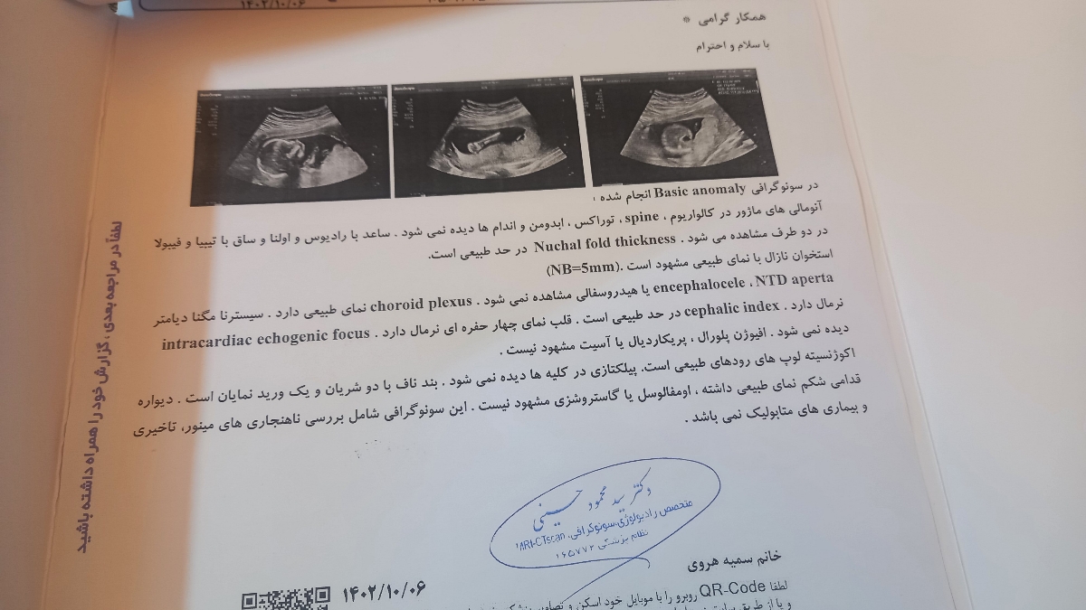 آ اس آ ۸۰ یا همون آسپرین در بارداری آ اس آ ۸۰ یا همون آسپرین در بارداری