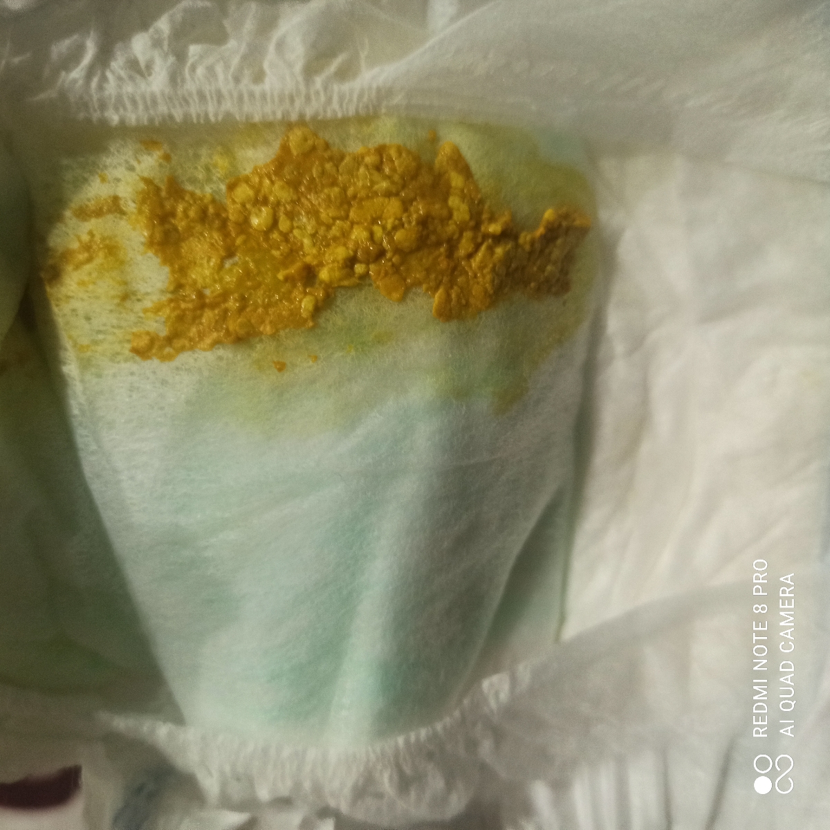 مدفوع نوزاد + (عکس) مدفوع نوزاد + (عکس)