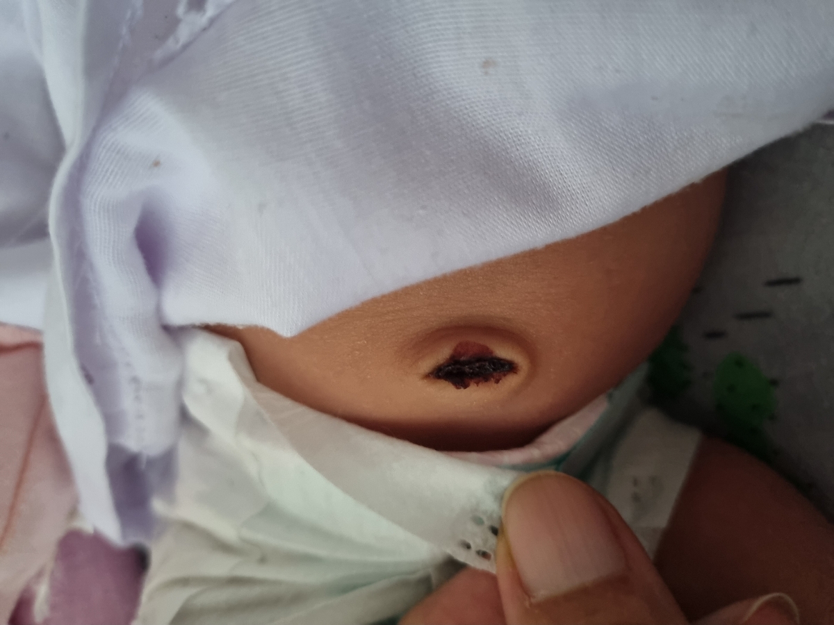 دو روزه این شکلیه خانم دکتر
من بهش نه دست زدم نه چیزی زدم
راستش قصد حمام بردنش رو داشتم دیگه به همین خاطر دست نگه داشتم
نظر شما چیه؟
کار خاصی لازمه انجام بدیم یا صبر کنیم