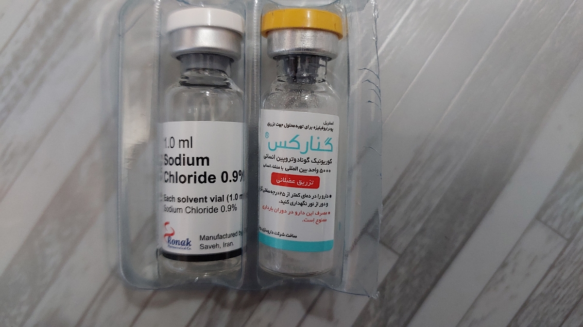 سونو فولیکول و زمان اقدام