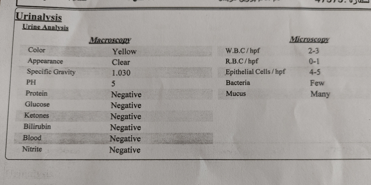 خدمت شما این آزمایش ادرار که همراه گلوکز و بقیه موارد انجام دادم