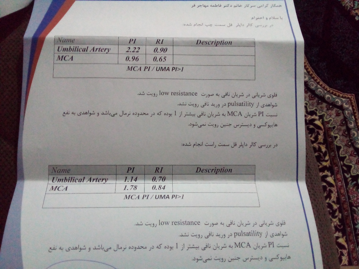 بررسی سونو داپلر جنین بارداری دوقلویی