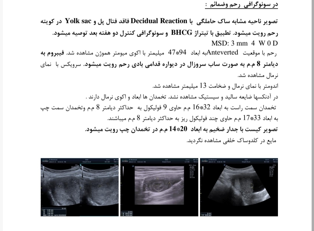 لطفا سونوگرافی رو تفسیر کنید..😔