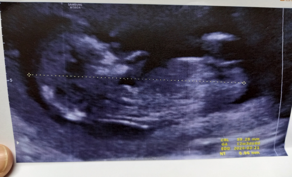 روز پسر منم مبارک مرد اینده🥺😍