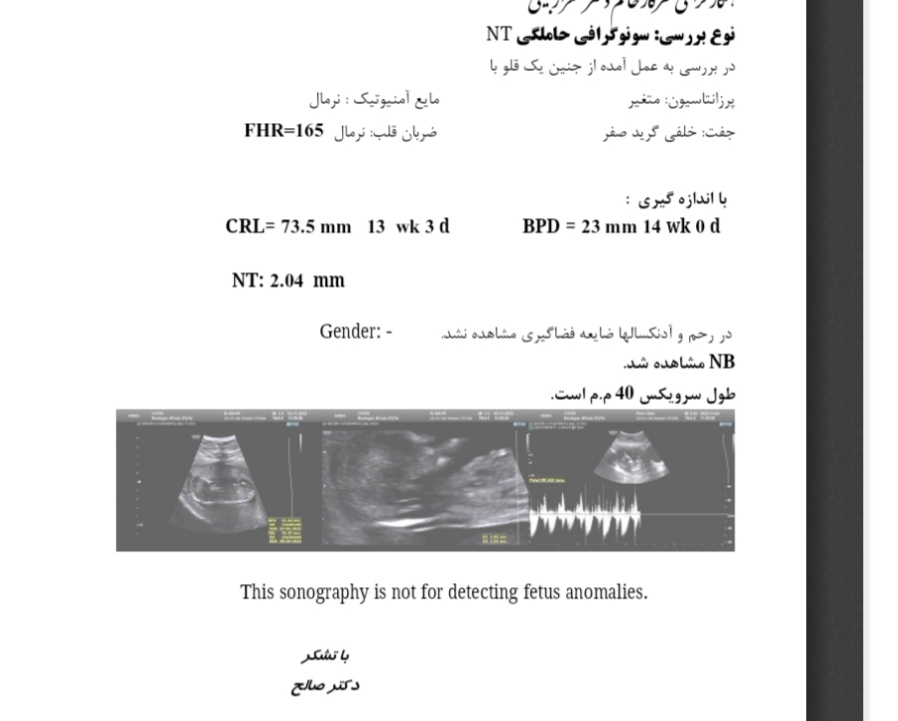 سونوی انتی و متخصصای جنسیت😅