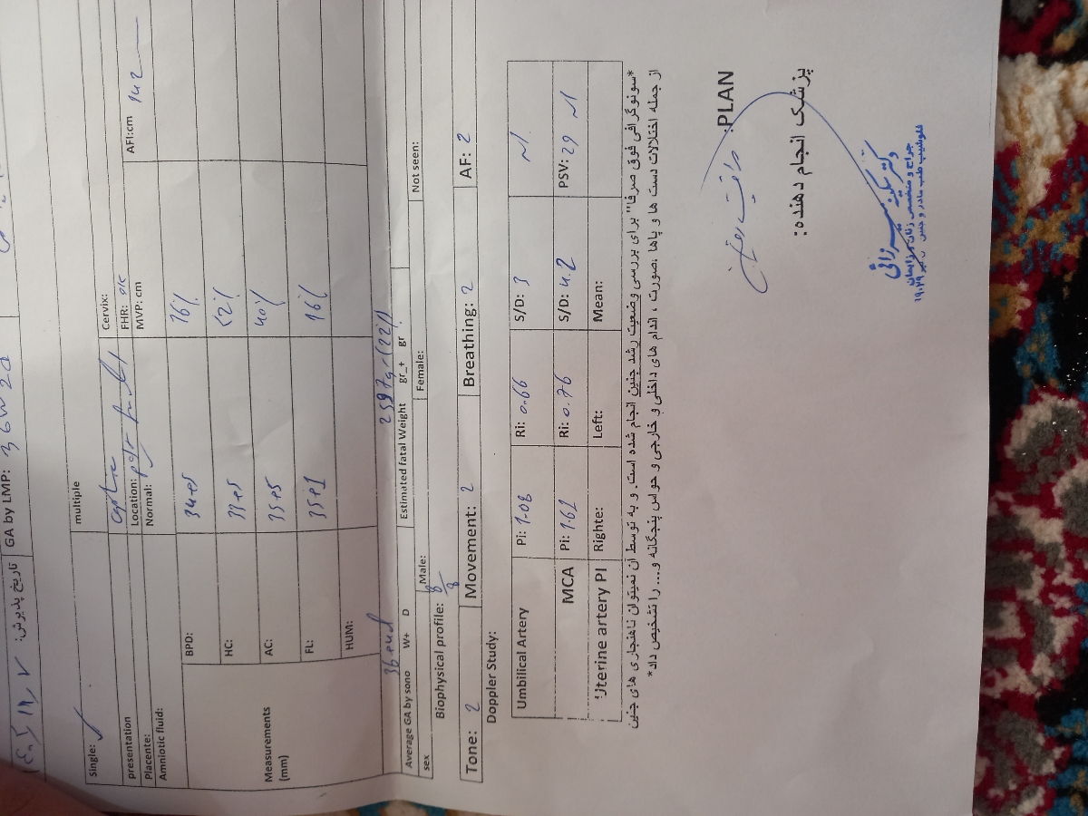 سلام ممنون میشم سنو داپلر منو  بررسی کنید