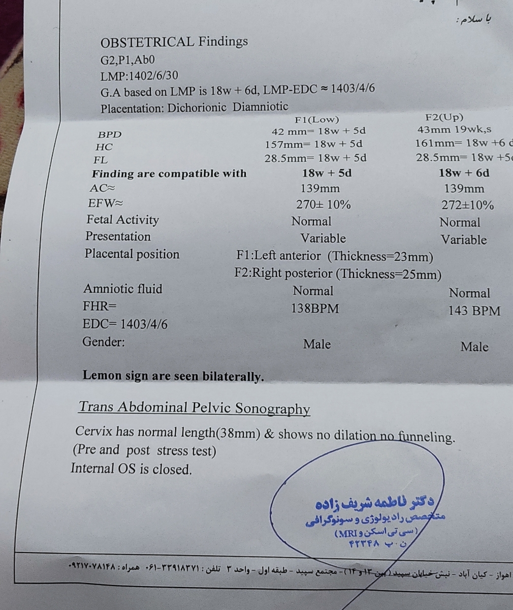 جمجه لیمویی شکل انومالی