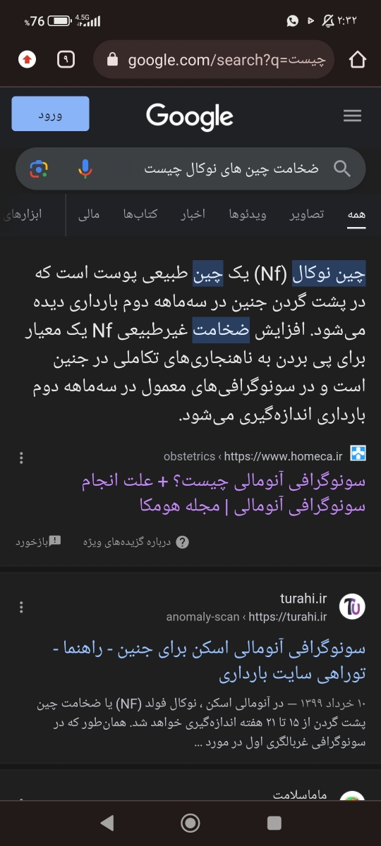 جمجه لیمویی شکل انومالی