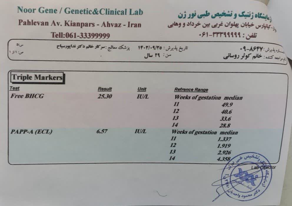 جمجه لیمویی شکل انومالی