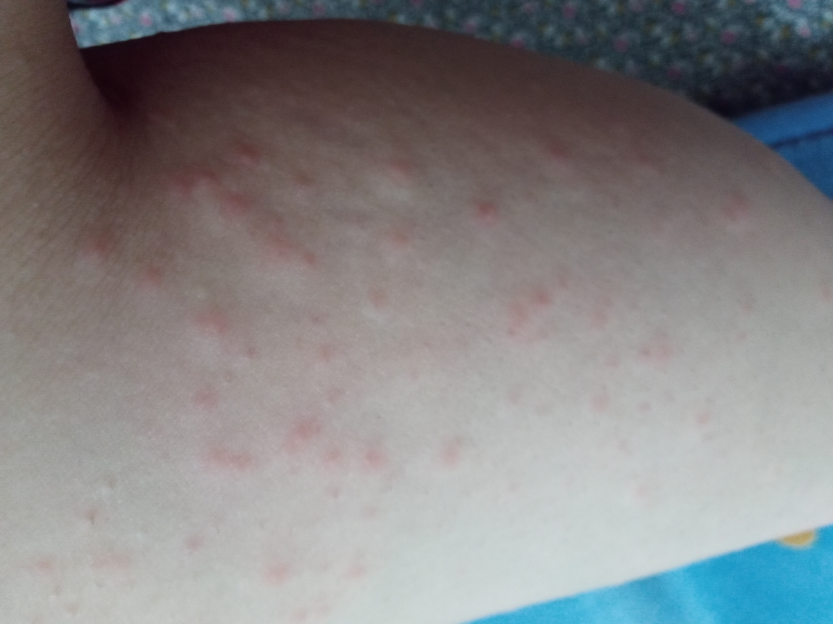 اینجوری شده هر دو تا پاهام از زانو به پایین