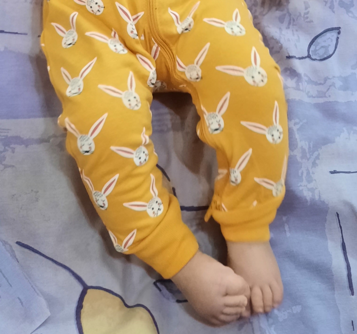 پا زدن نوزاد بعد واکسن پا زدن نوزاد بعد واکسن