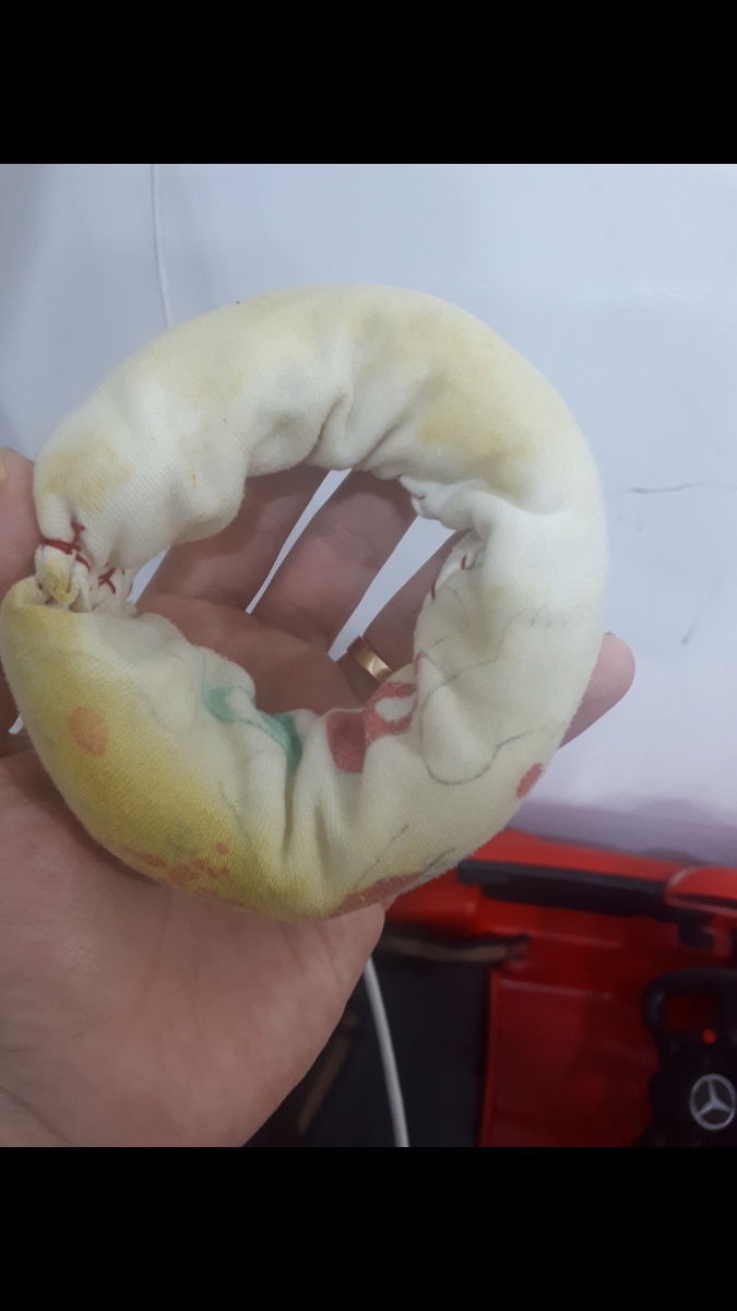 ختنه و عفونت کودک ختنه و عفونت کودک