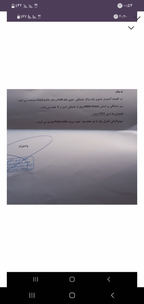این سونو اولمه 