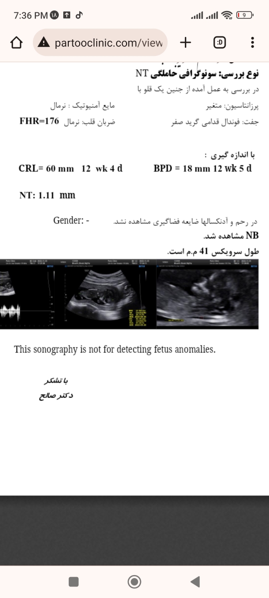 جواب آزمایش ان تی