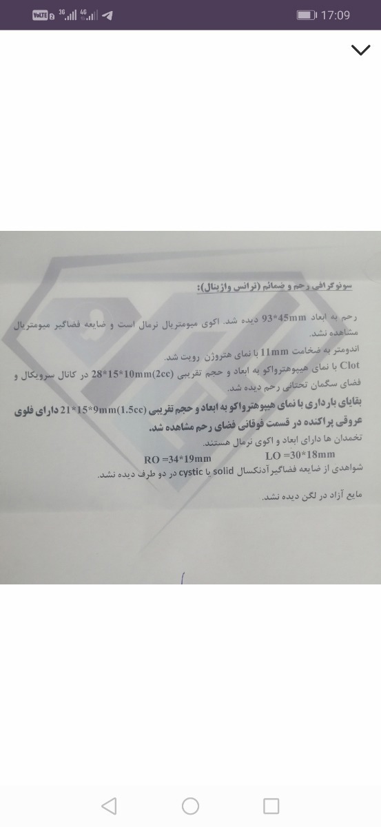 سونو قبلی