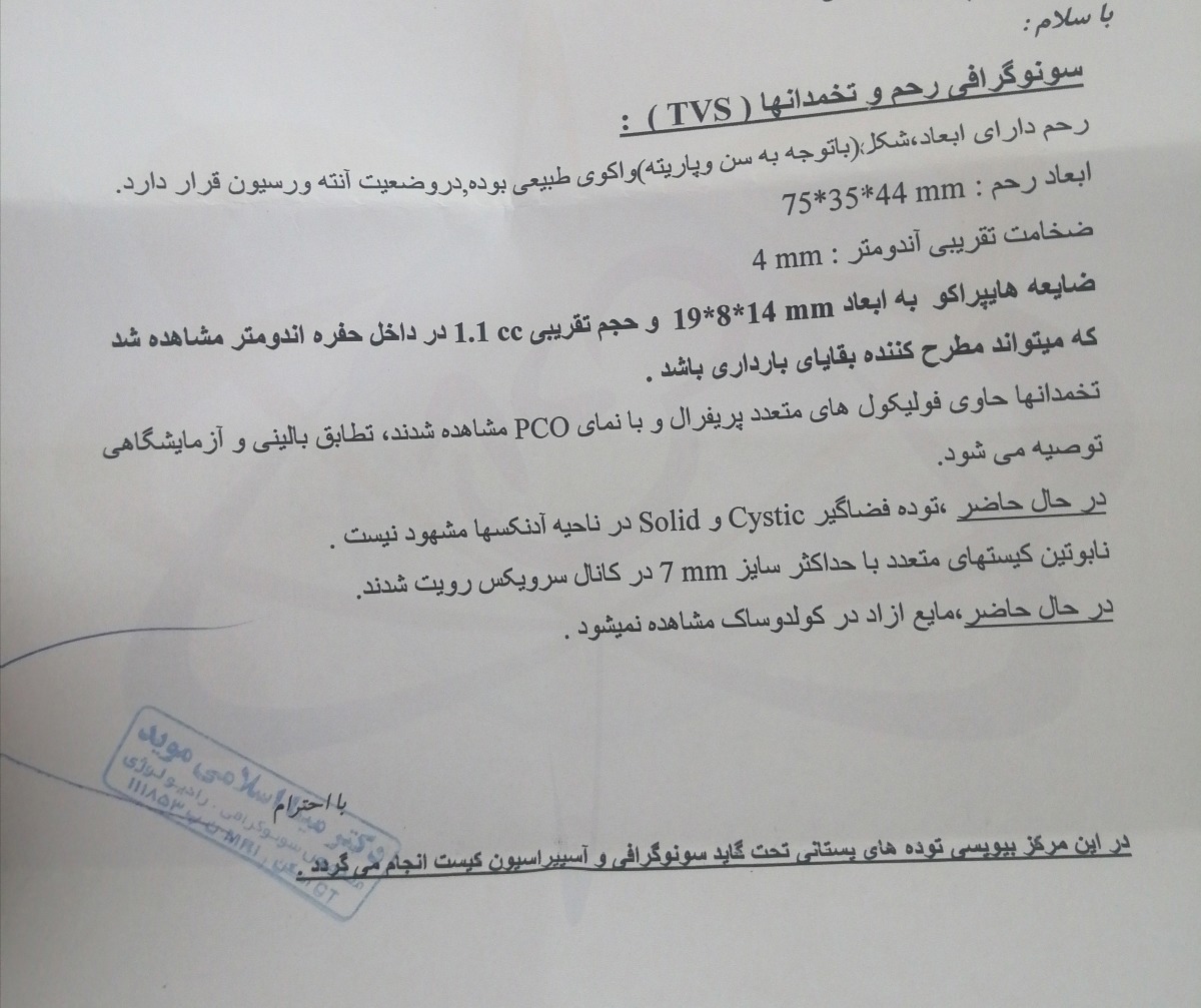 سونو جدید