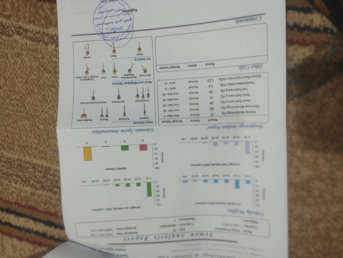 آزمایشات سقط مکرروdfi همسرم