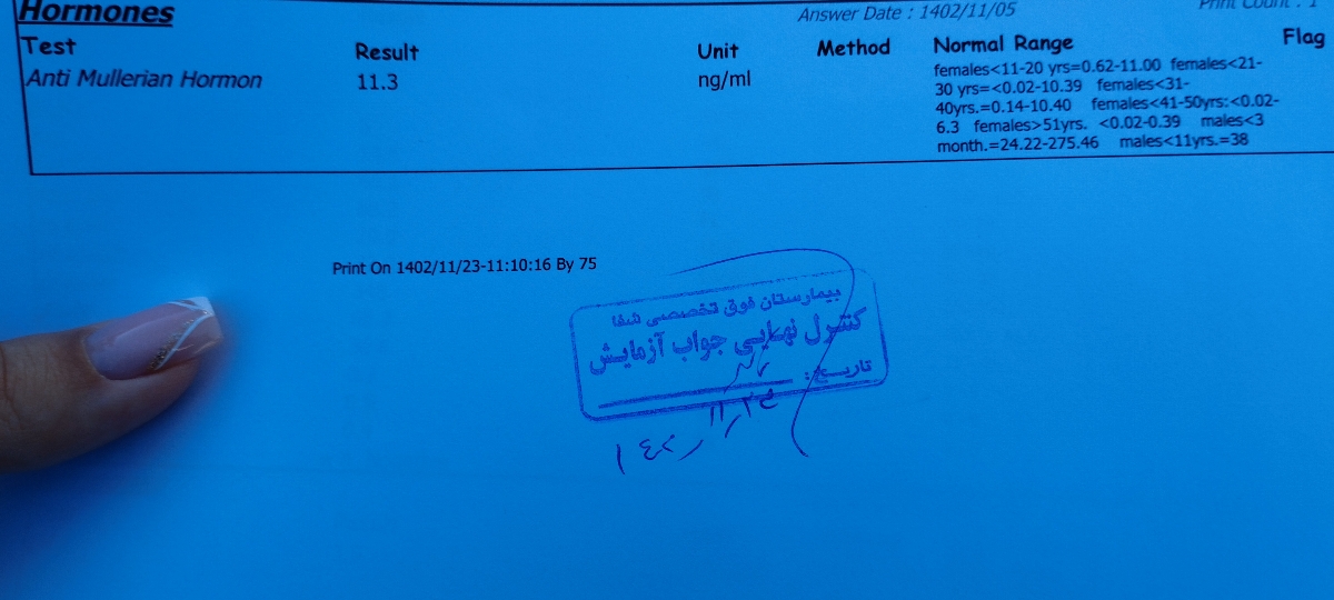 آزمایش ذخیره تخمدان تفسیر