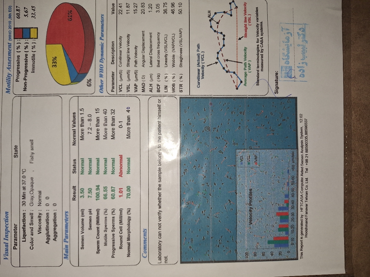 آنالیز و تفسیر آزمایش اسپرم