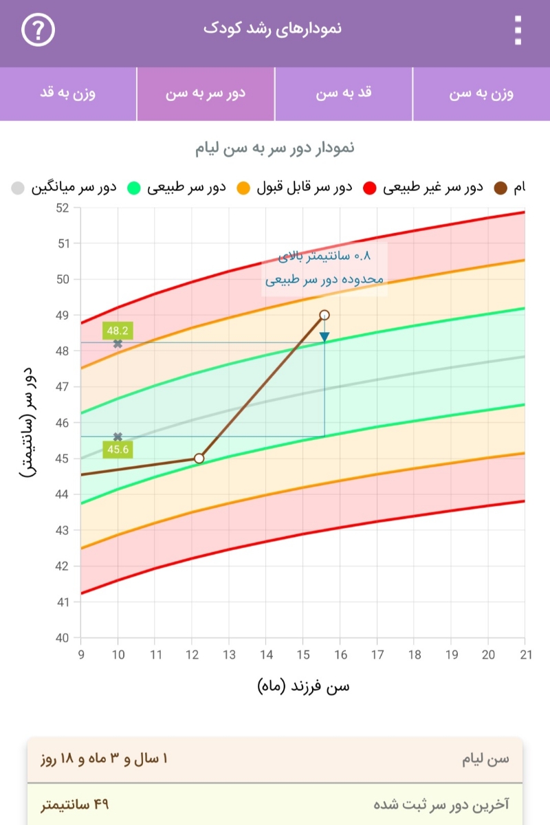 دور سر