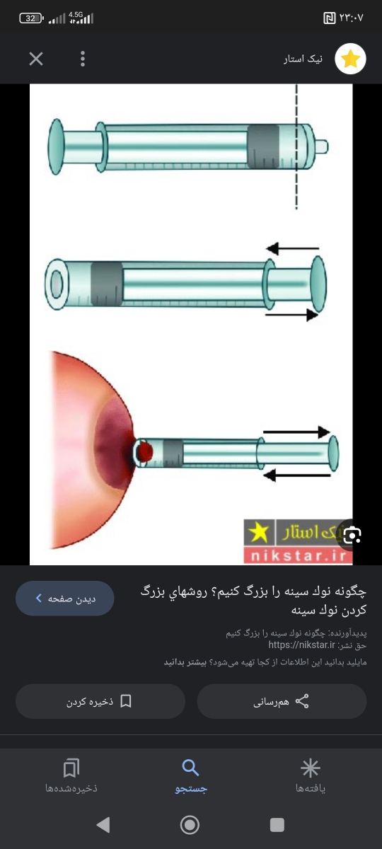 سینه نگرفتن نوزاد بدو تولد