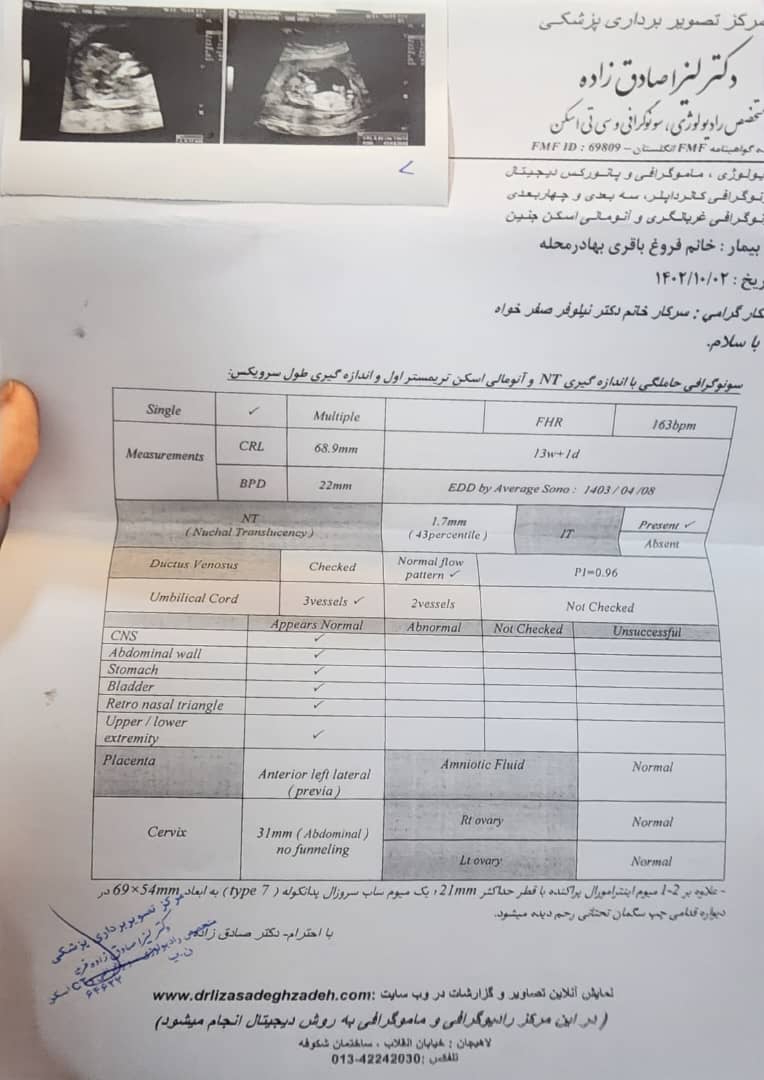 سونوگرافی طول سرویکس و مایع دور جنین