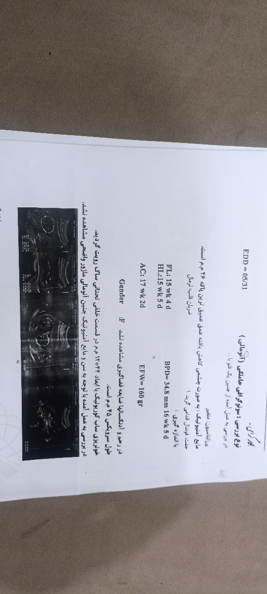 هماتوم ۱۲×۴۴ میلی متر در سونوی انومالی