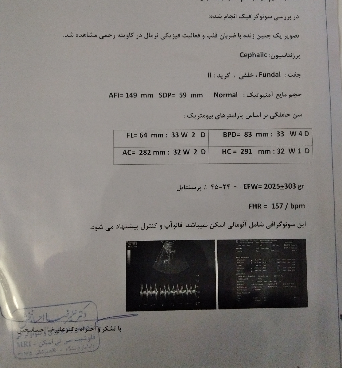 سونو 32 رو انجام دادم وزن بچه 2 کیلو هست ؟ایا مولتی ویتامین هر روز ادامه بدم