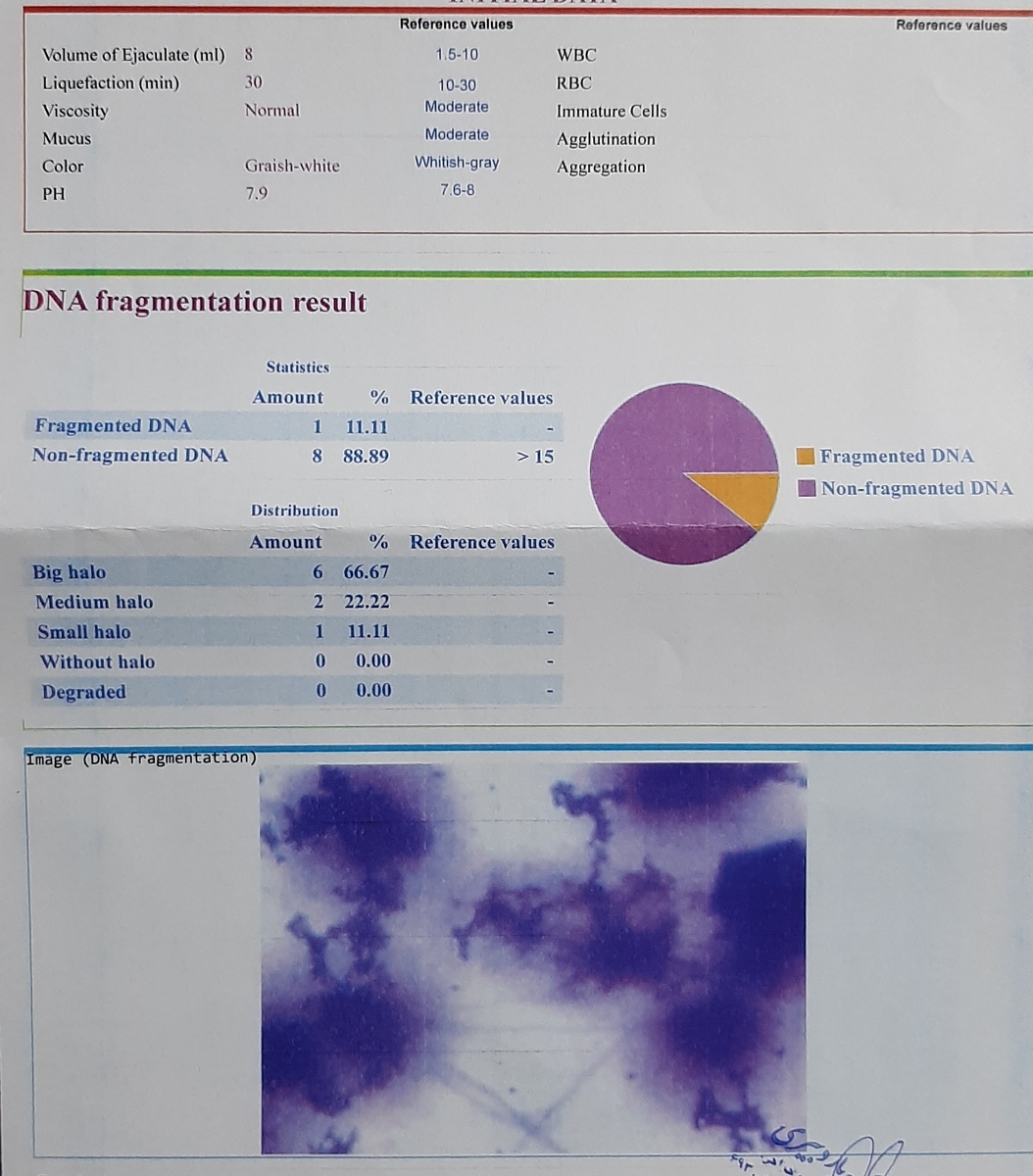 خانم دکتر عزیز ازمایش اسپرم آقام تفسیر میکنید