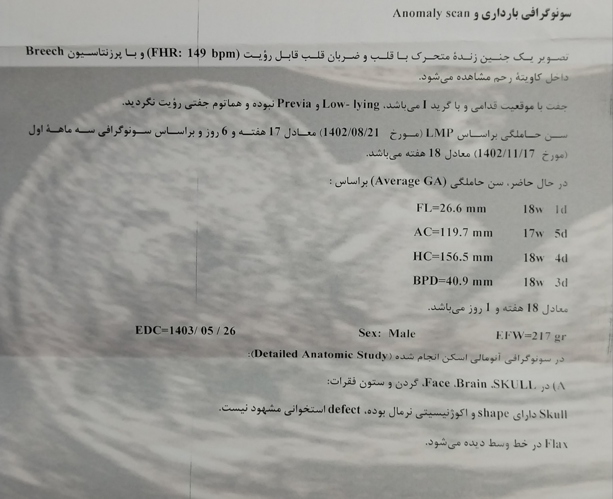 سونو 18 هفته آنومالی