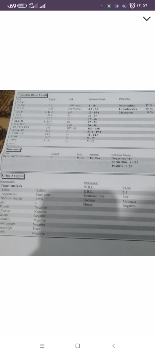 خانم دکتر این آزمایش مال همون خرداد ماه هست دقیقا رنج هموگلوبین همین هست که توی آزمایش اخیر بوده بدون ذره ای تغییر، پس چرا اون زمان راجع ب کم خونی چیزی ب من نگفتن😢