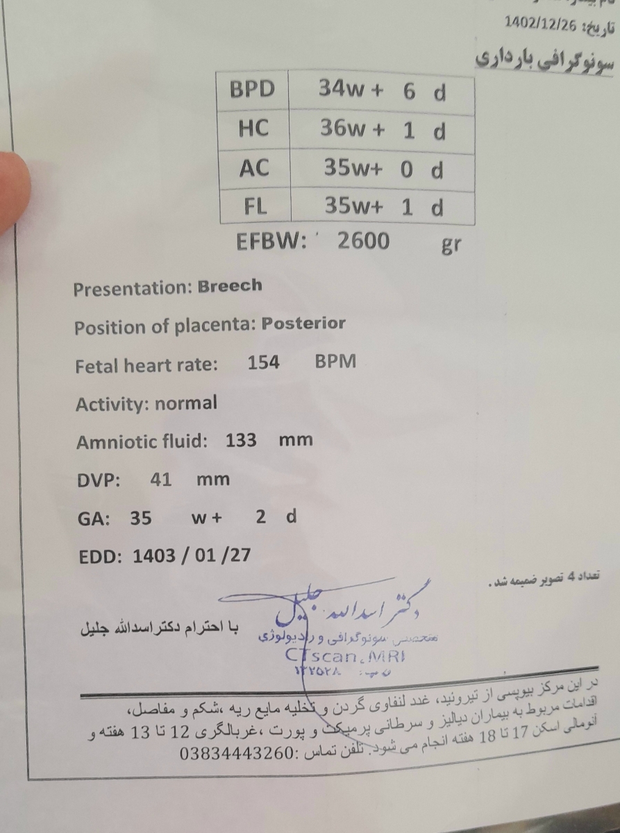 زایمان بریج و سزارین