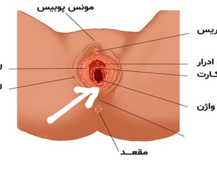 دوتا گوشه این قسمت پایین رو به داخل بدنم قرمز بود