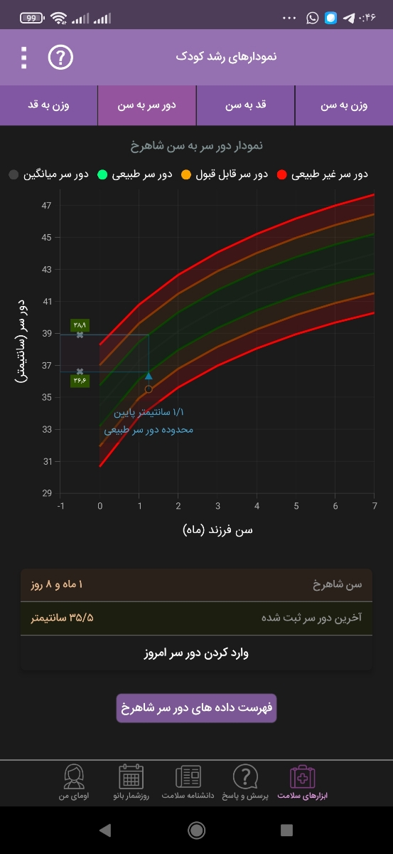 کم بودن دور سر نوزاد