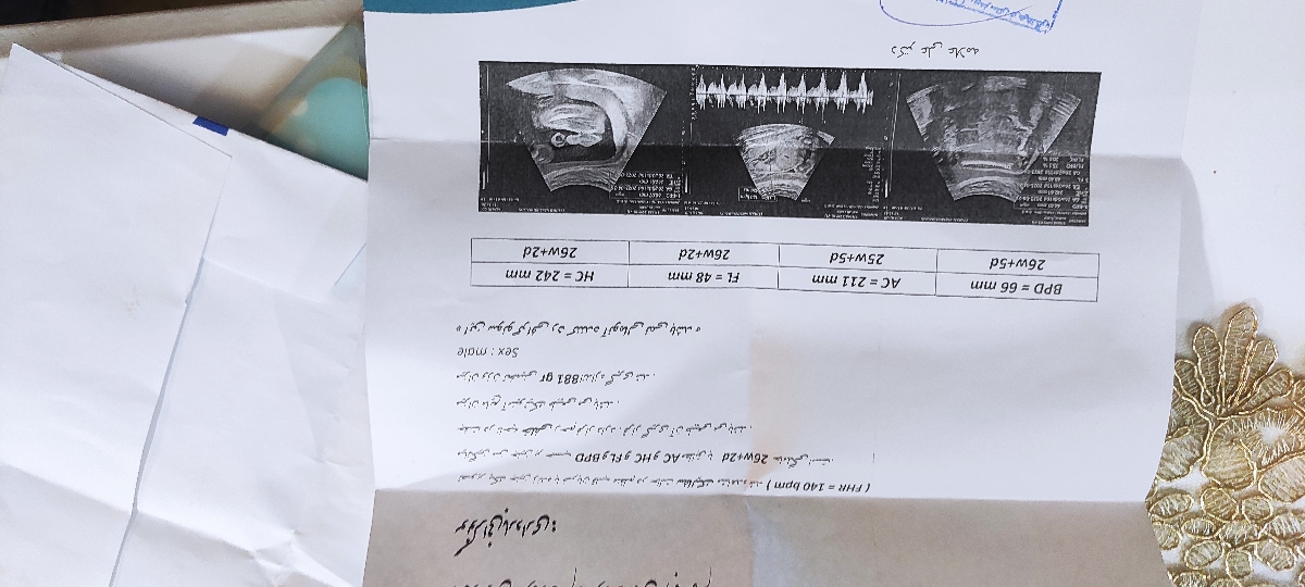 سونوگرافی بارداریم و برام تقسیر میکنید